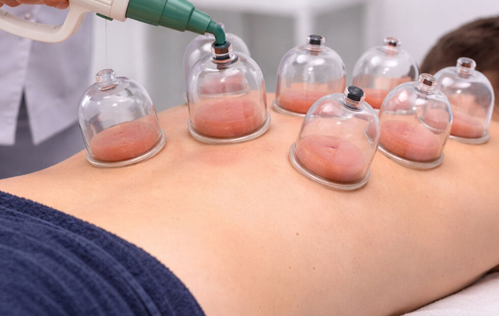 beitragsbild_schroepftherapie_ortho_achim_01